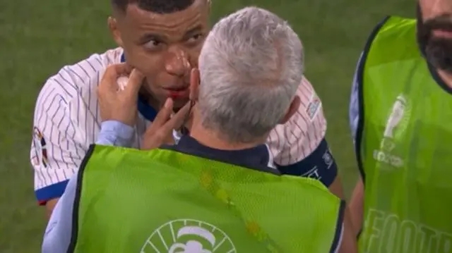 姆巴佩鼻子受伤，法国足协：不手术，带面具出战